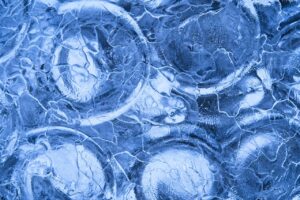 ワキガの症状は思春期に悪化するの？